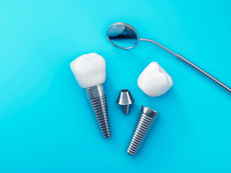 Dental implants and a dental mirror on a blue background. The image features two dental implants with white crowns attached, a separate white crown, an abutment, and a dental mirror.